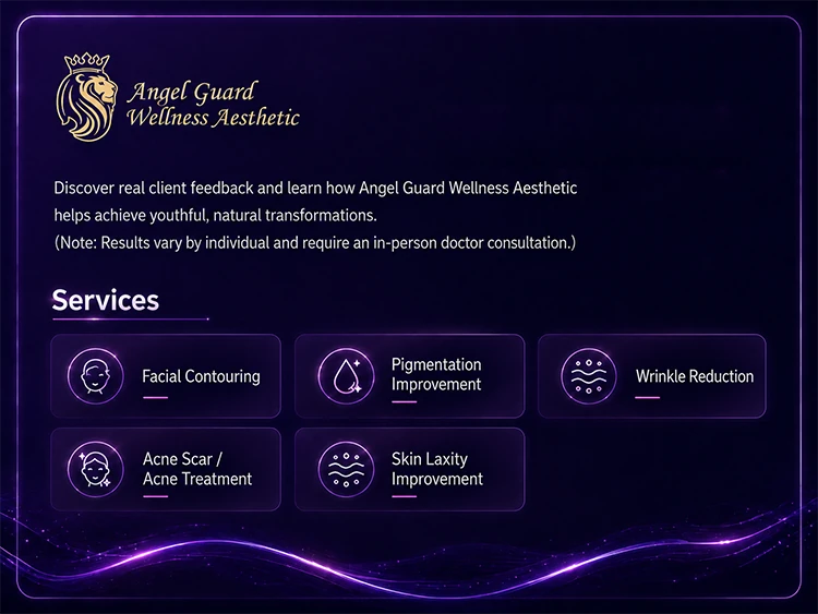 Angel Guard service summary